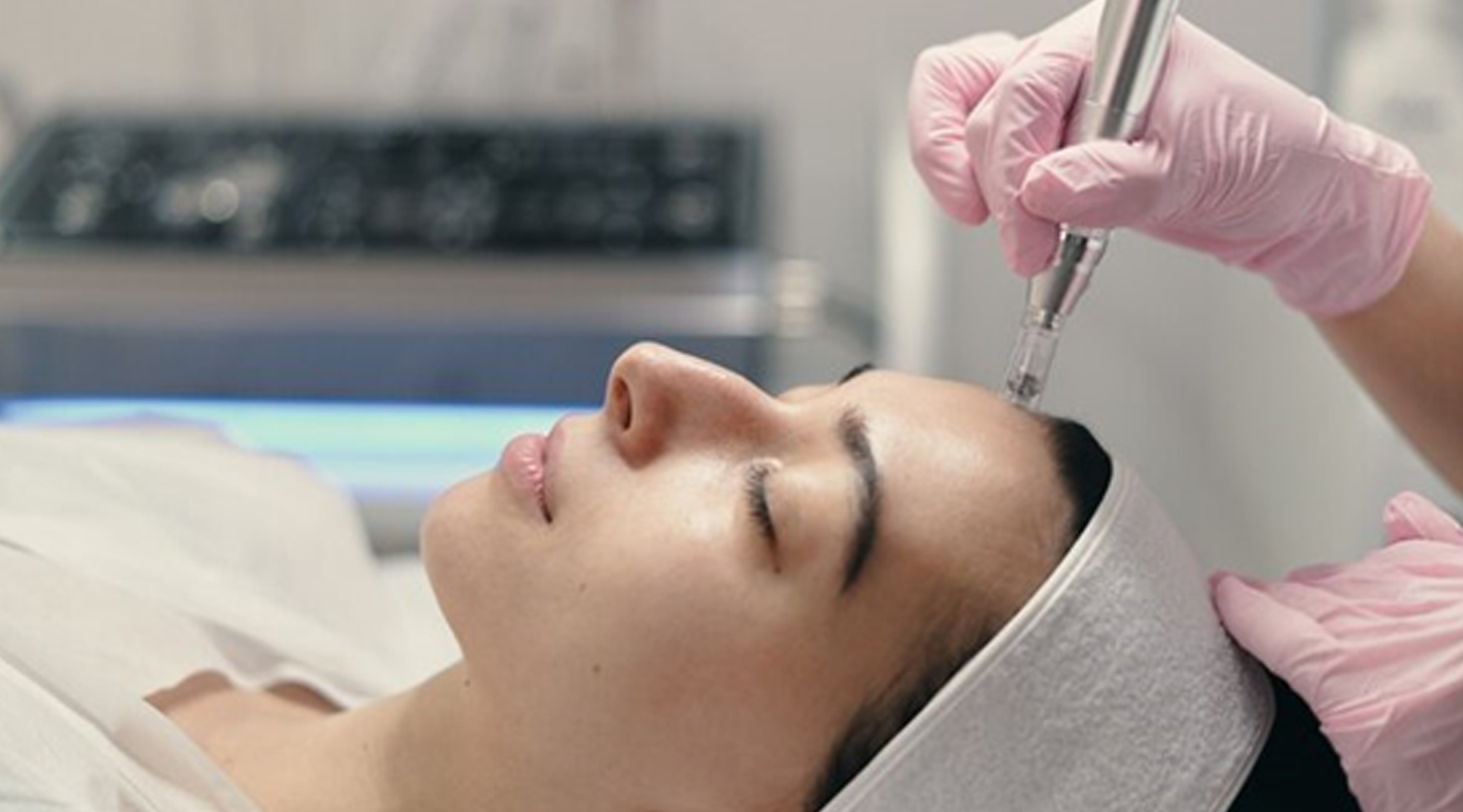 The Ultimate Guide to Microdermabrasion for Estheticians